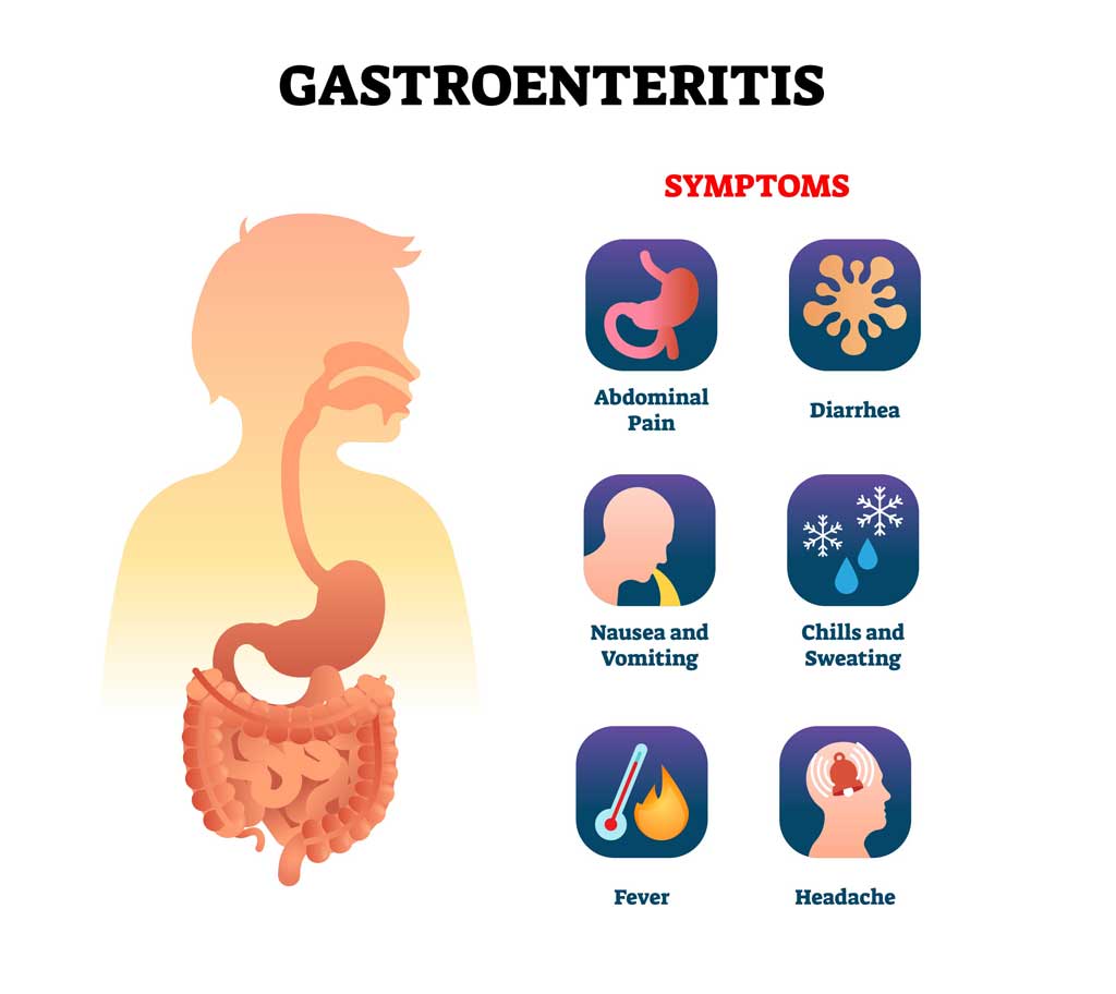 norovirus-foodborne-illness